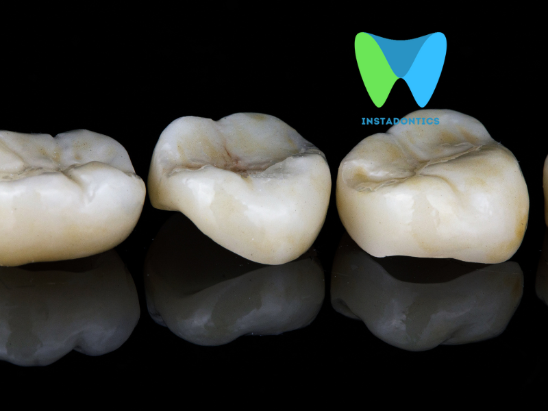 What causes tooth decay under a crown ?