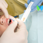 Dental Fluoride Varnish