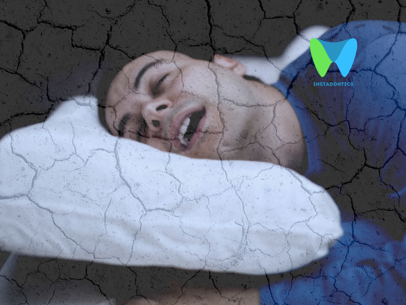 Causes of Dry Mouth While Sleeping