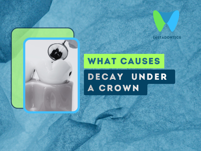 What causes tooth decay under a crown ?