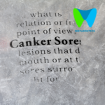 canker sores