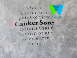 canker sores