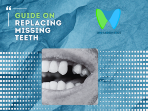 Options for Replacing Missing Teeth