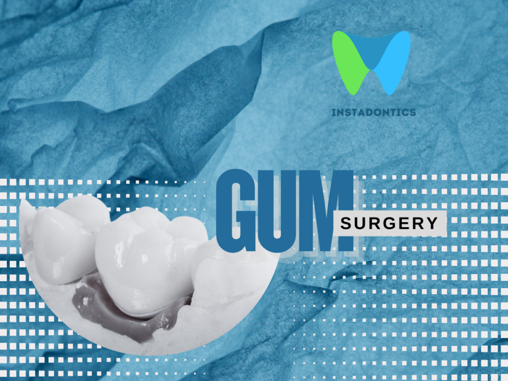 When Do You Need Gum Surgery? An In-Depth Analysis