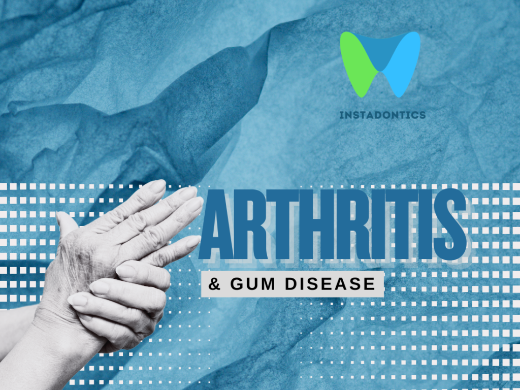 Rheumatoid Arthritis and Gum Disease