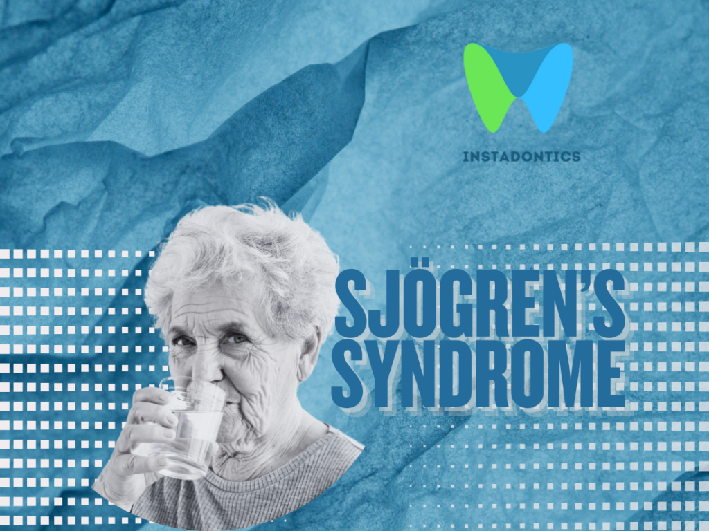 Sjögren’s Syndrome