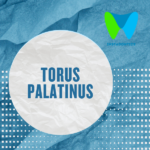 Torus Palatinus