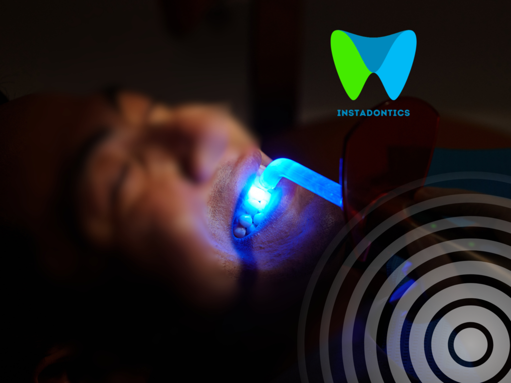 What is The Blue Light Dentists Use For Fillings?