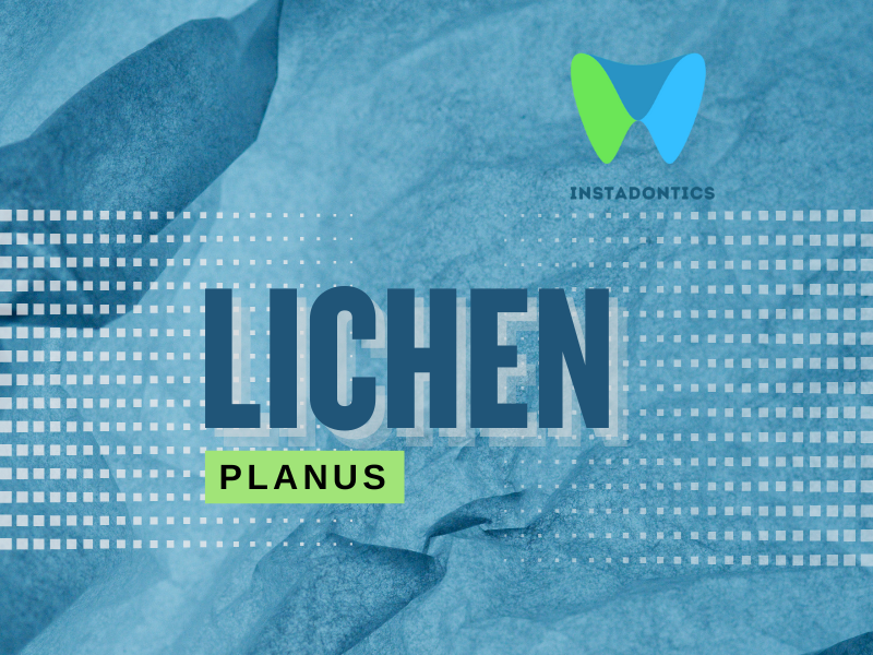 Lichen Planus