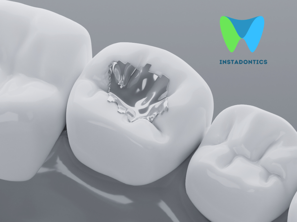 Amalgam Fillings vs Composite