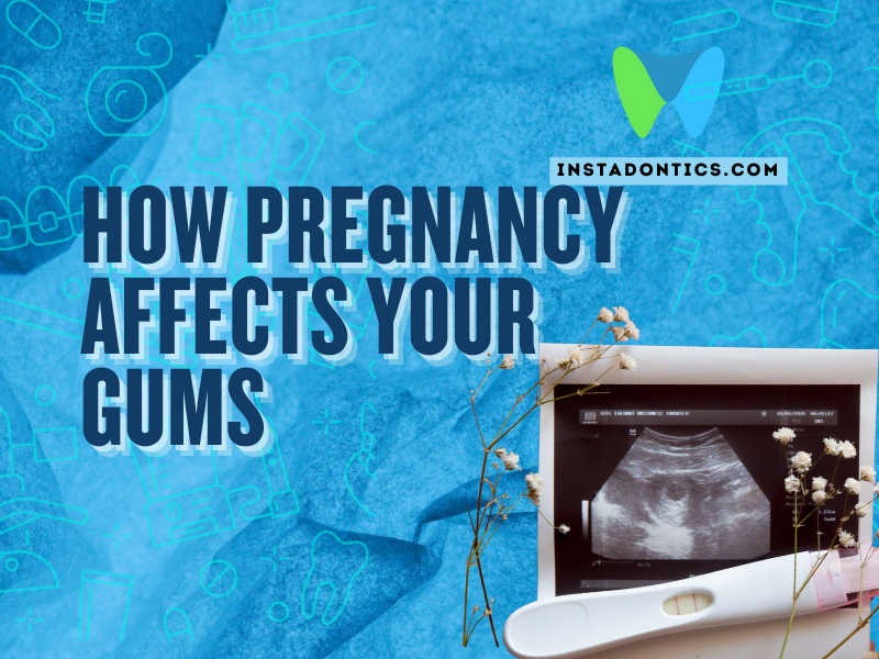 How Pregnancy Affects Your Gums: A Comprehensive Guide
