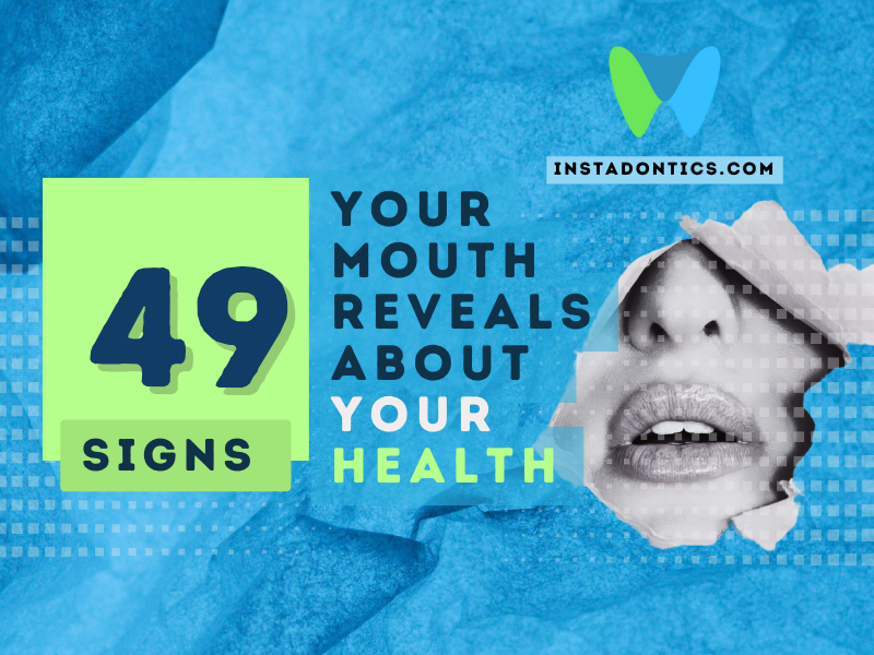 Signs Your Mouth Reveals About Your Health
