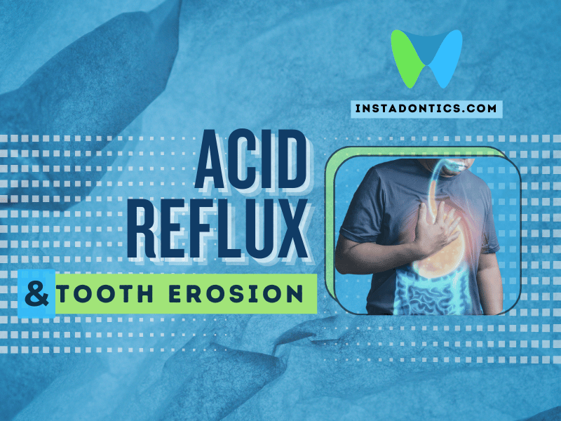 Acid Reflux and Teeth Erosion: Causes & Solutions