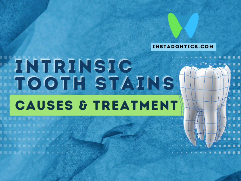 Intrinsic Tooth Stains | Causes & Treatment
