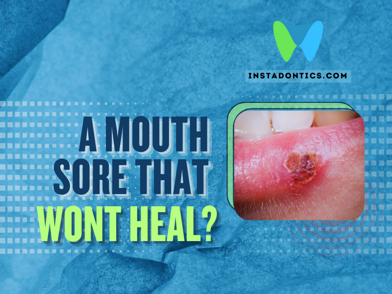 A Mouth Sore That Won't Heal