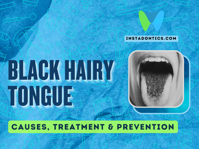 Black hairy tongue