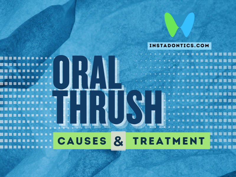 Oral Thrush in Adults : Causes, Symptoms & Treatment