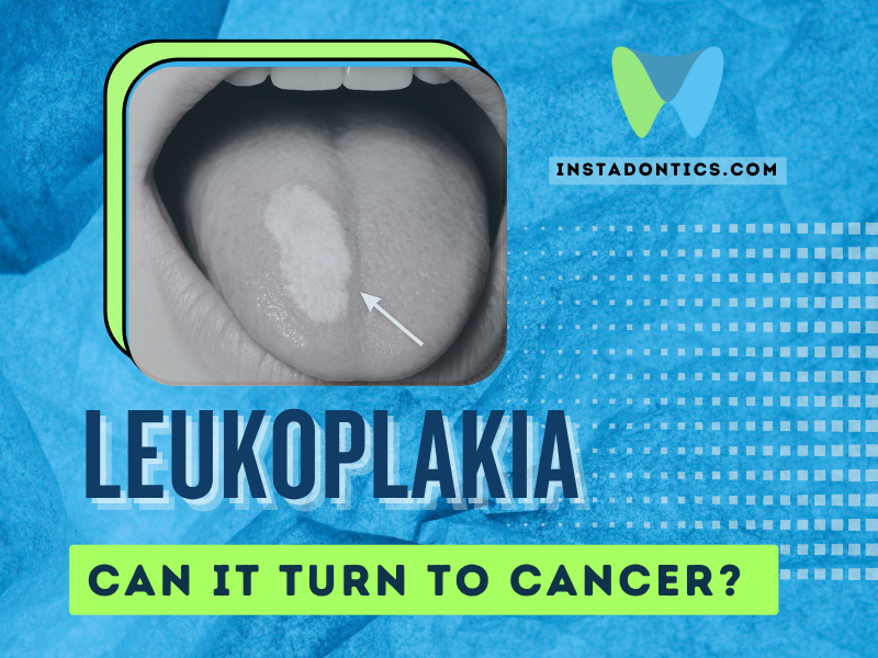 Leukoplakia white patches