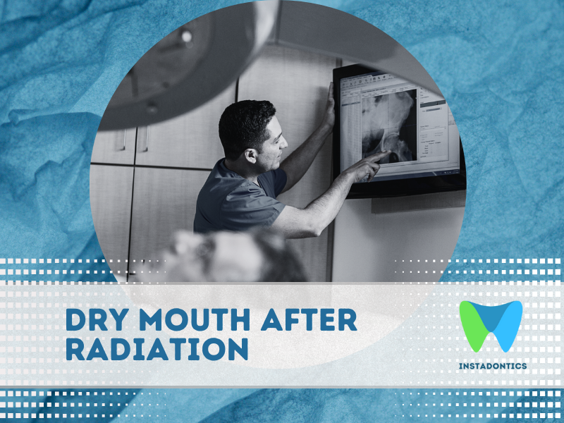 Dry mouth after radiation