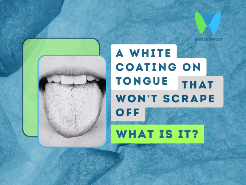 White Coating on Tongue That Won't Scrape Off: Causes and Management