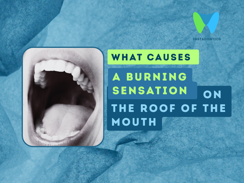 Burning Sensation on Roof of Mouth Only