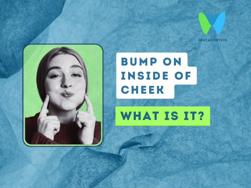 Bump on Inside of Cheek That's Been There for Weeks: Causes and Management