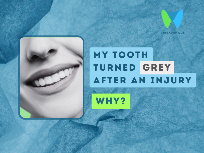 Tooth Turned Slightly Grey After a Hit or Injury: What It Means