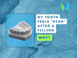 Tooth Feels High After a Filling, Days Later: What to Do