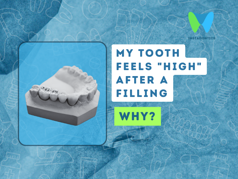Tooth Feels High After a Filling, Days Later: What to Do