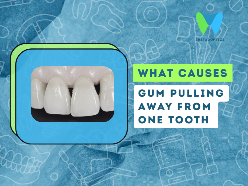 Gum Pulling Away From One Tooth Only: