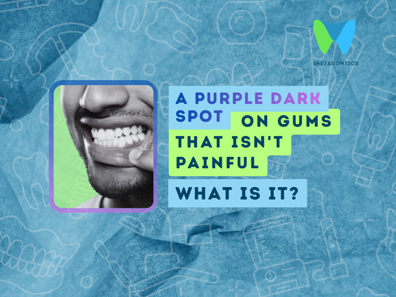 Purple or Dark Spot on Gum That Isn't Painful: What It Could Mean