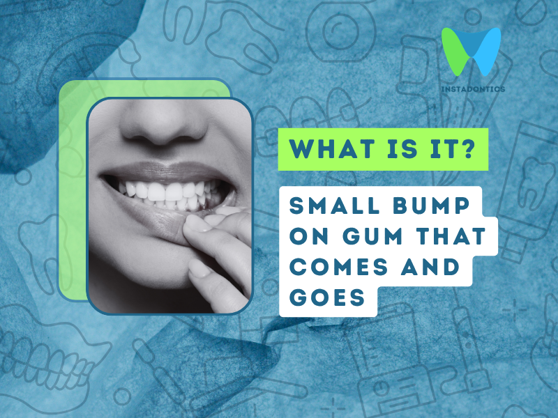 Small Bump on Gum That Comes and Goes: What It Means