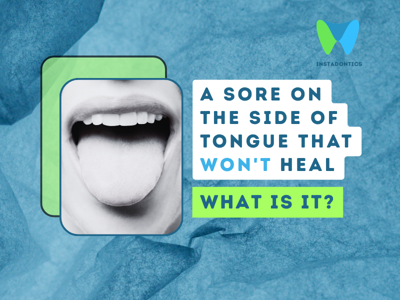 Sore on Side of Tongue That Won't Heal: Causes and How to Manage It