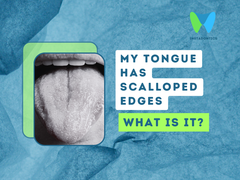 Tongue Has Ridges or Scalloped Edges